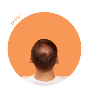 Fyll Premium Hair Fibers